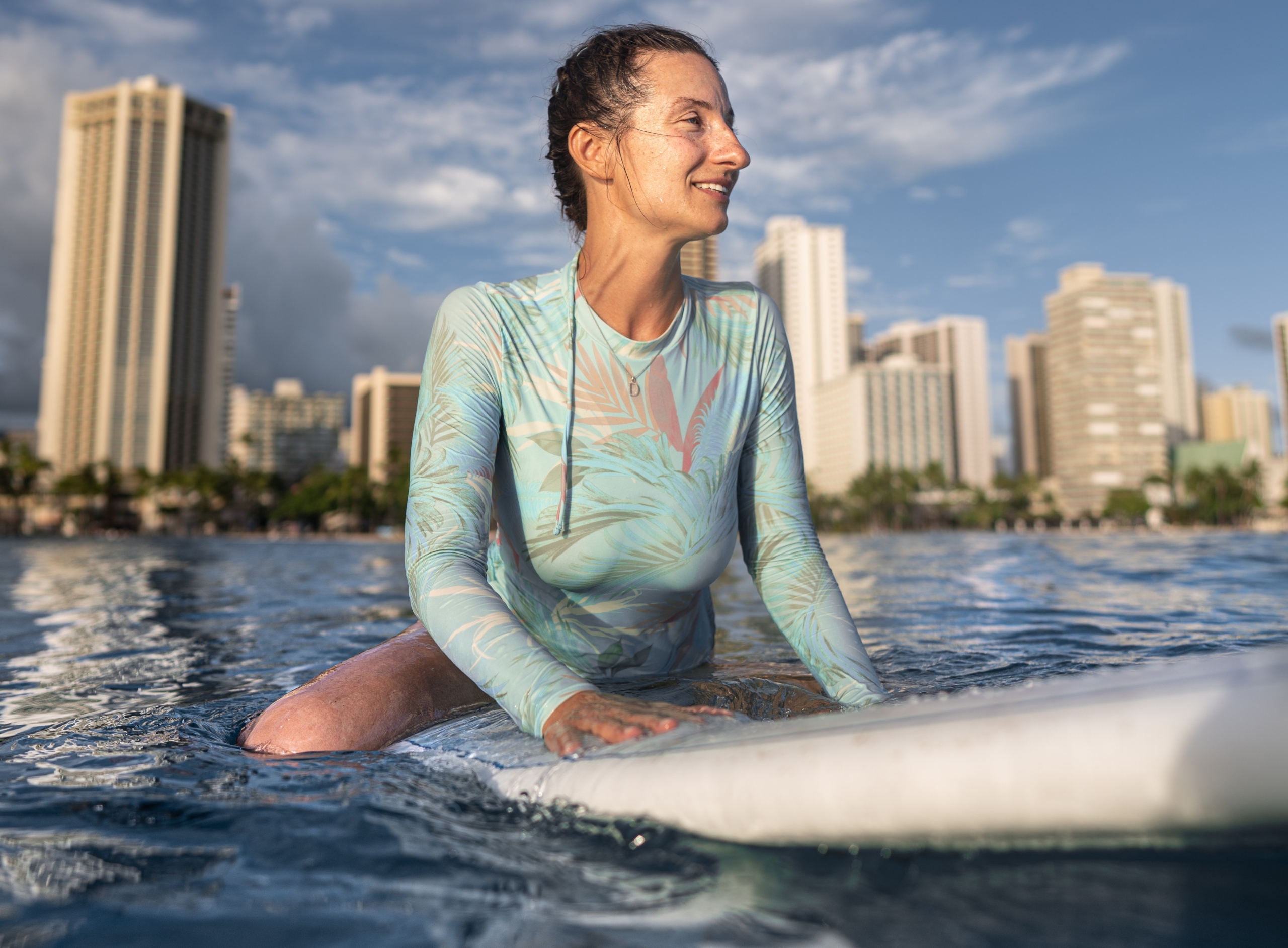 ¡A surfear sonrisas!: Un proyecto para niños con problemas medulares ¡A surfear sonrisas!: Un proyecto para niños con problemas medulares