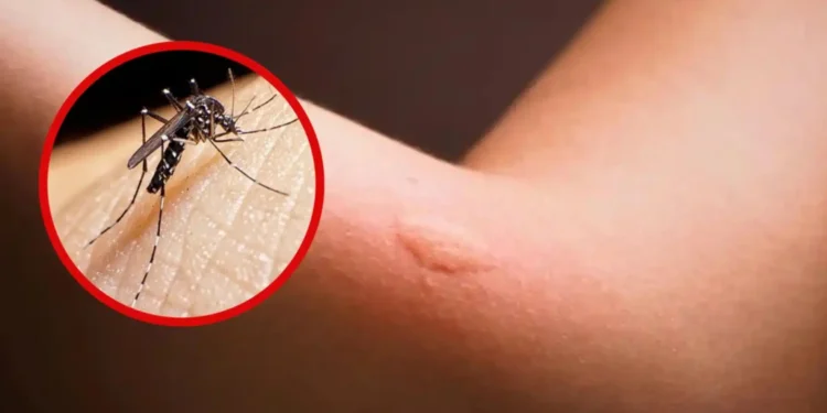 Intensifican lucha contra el dengue en Bahía de Banderas Intensifican lucha contra el dengue en Bahía de Banderas